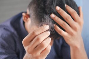 Read more about the article Why does hair fall out?